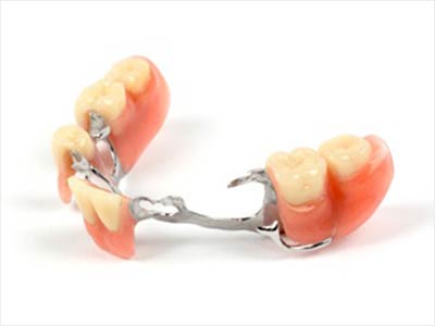 Clinique Cloutier denturologiste Montréal | Removable dentures